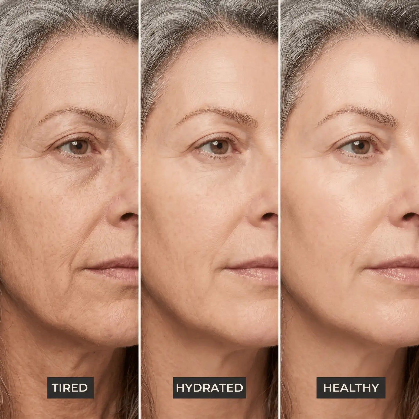 The Skin Stability System